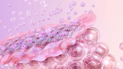 psoriase-espaco-de-vida