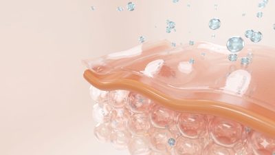 urticaria-espaco-de-vida